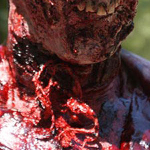wounds